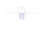 Bild Waschke Dieter - Dentalkeramisches Labor